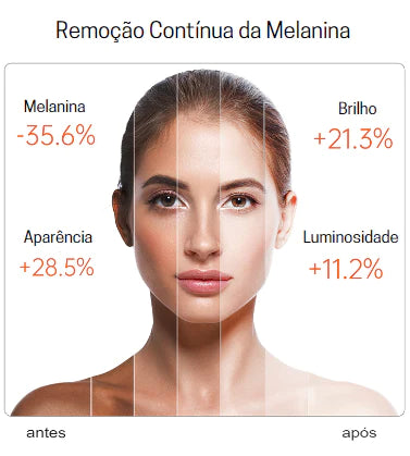 Vitamina C para o Rosto, Vitamina C para Rosto, Votamina C, Vitamina C para Pele, Vitamina C para o Rosto com Ácido Hialurônico , Vitamina C, Serum Vitamina C para o Rosto, Sérum Vitamina C para o Rosto, Clareador de Pele, C Vitamina